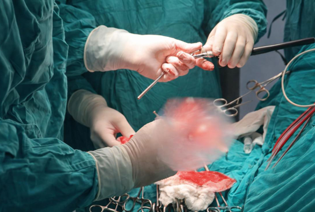 DOBOJ: U bolnici „Sveti apostol Luka“ prvi put uspješno operisan tumor na mozgu