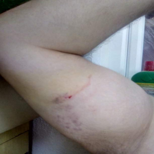 nasilje-nad-gradjaninom-01