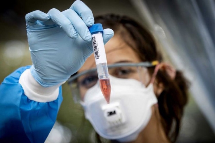 U Srpskoj još 18 osoba preminulo od korone, 125 novozaraženo