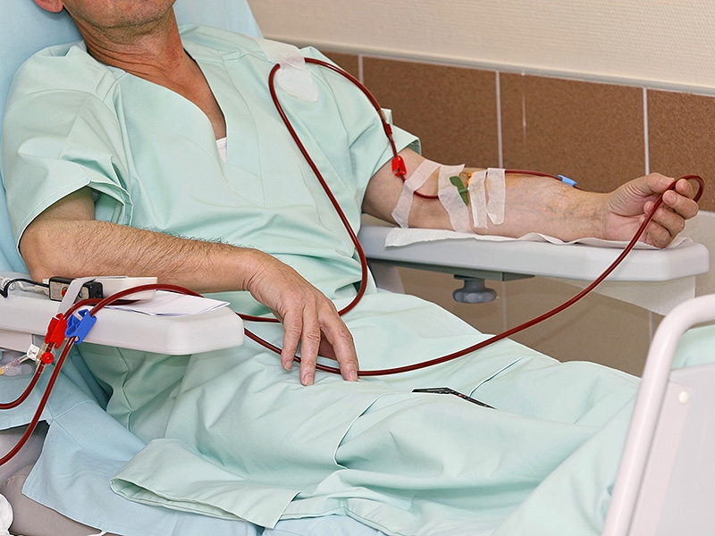 OTVORENO PISMO Udruženja dijaliziranih, transplantiranih i hroničnih bubrežnih bolesnika Regije Doboj