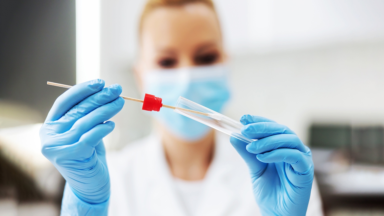 BOLNICA Doboj: Izmjene termina uzimanja uzoraka za testiranje