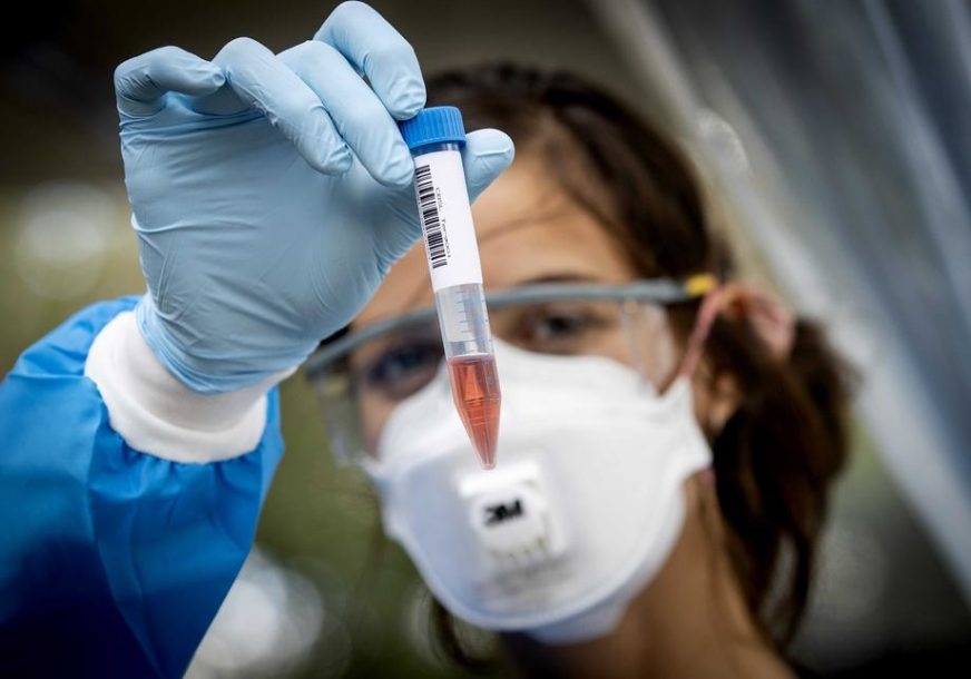 NAJVIŠE ZARAŽENIH IZ BANJALUKE Na korona virus pozitivne još 52 osobe u Srpskoj