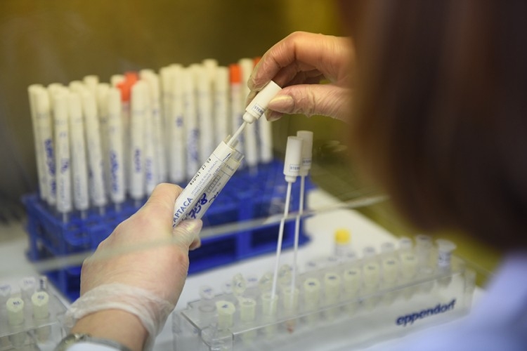 Sa zarazom se nije izborilo 12 pacijenata: Na virus korona pozitivne još 163 osobe u Srpskoj
