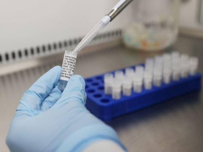 PREMINULO PETORO LJUDI Korona virus potvrđen kod još 323 osobe u Srpskoj