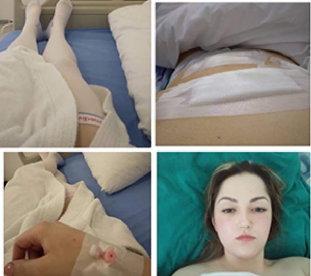 “Nedostaje još 1.000 KM”: Nataša Ćejić treba pomoć dobrih ljudi da bi se izliječila