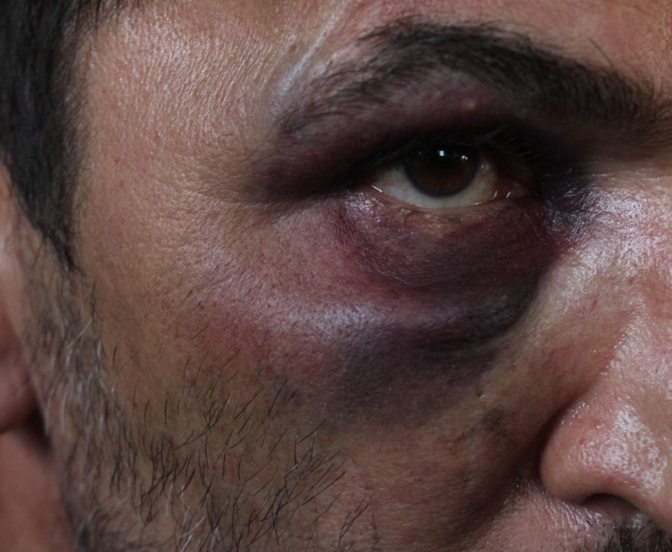 DOBOJ: Natjerali ga da se skine i prijetili mu silovanjem