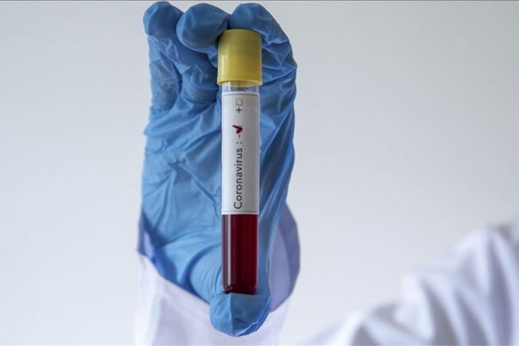 Iz BiH u Crnu Goru samo uz negativan test