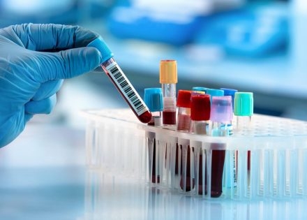Da bi uradili krvne pretrage više ne morate da idete u laboratoriju