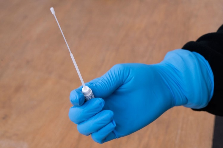 Još 31 slučaj virusa korona u RS, novi klaster u modričkoj fabrici