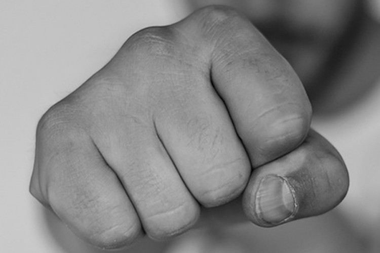 DOBOJ: Tuča na benzinskoj pumpi