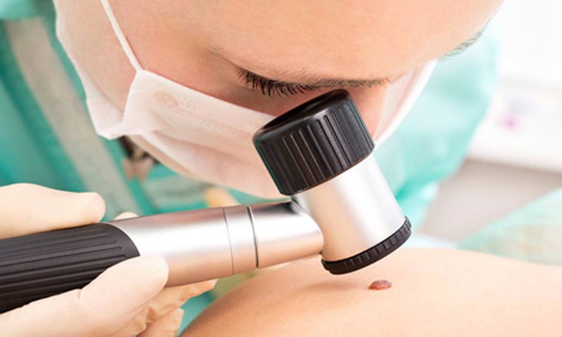 DOBOJ: Danas besplatni dermoskopski pregledi mladeža