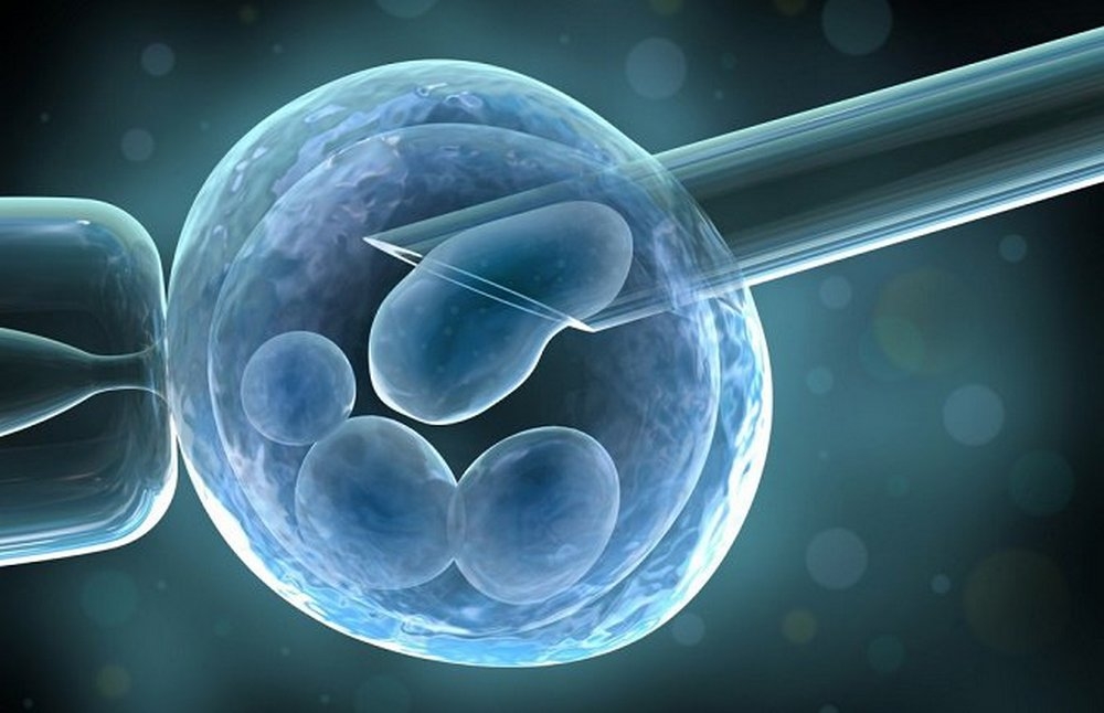 DOBOJ: Objavljen javni konkurs za sufinansiranje vantjelesne oplodnje