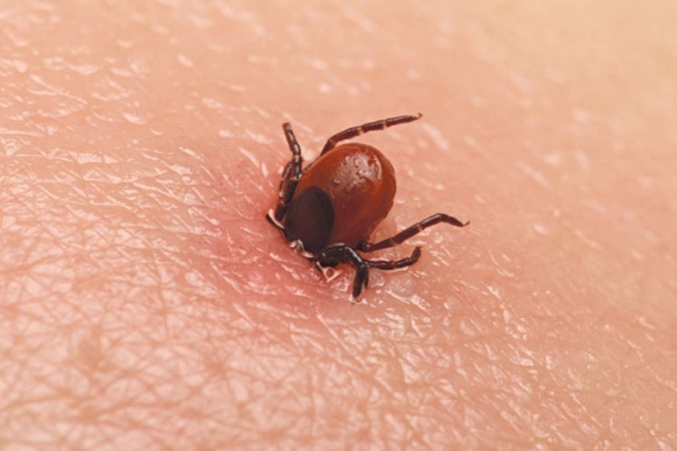 DOBOJ: Oboljela od Lajmske bolesti, ujeda krpelja se ne sjeća