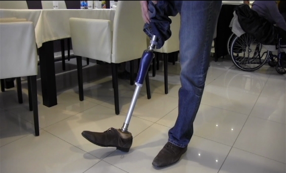 DOBOJ: Amputirci se muče sa nabavkom proteza i njihovim kvalitetom (VIDEO)