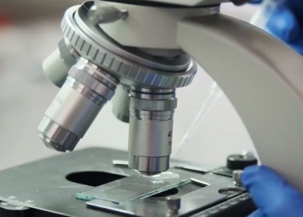 Kako da ne platite “krvne analize” ako javna laboratorija ne može da ih izvrši?