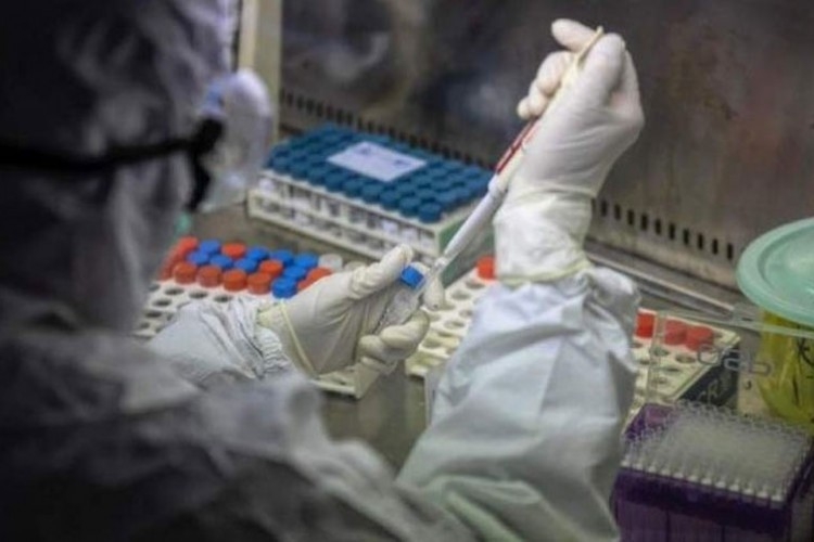 U Srpskoj korona virusom zaraženo još šest osoba, dvije preminule