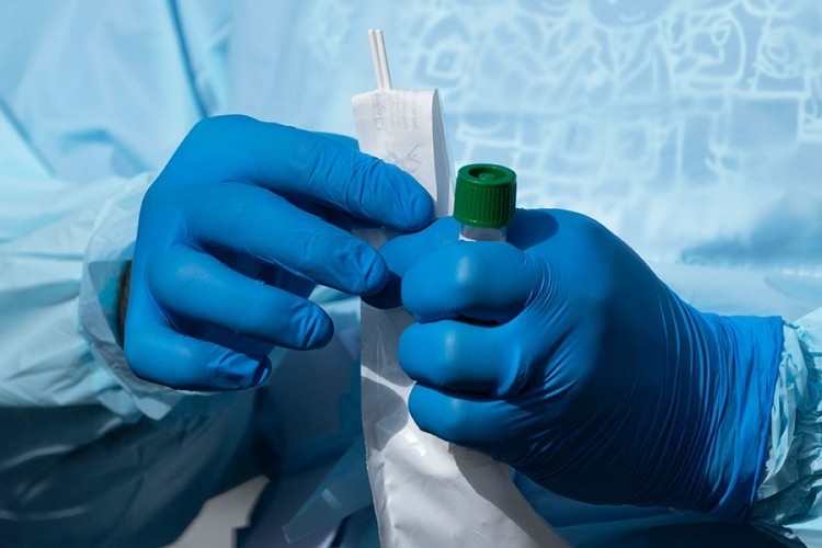 Preminulo pet osoba pozitivnih na koronu, još 323 oboljelih u Srpskoj