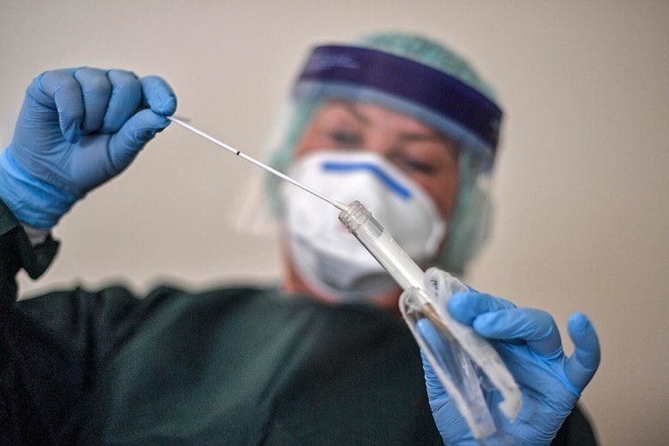 ZARAŽENO JOŠ 17 OSOBA U SRPSKOJ Korona virus potvrđen i kod jednog ljekara iz UKC