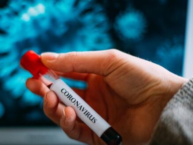 U Srpskoj preminulo pet osoba, 25 novozaraženih