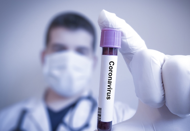 PREMINULA ČETIRI OBOLJELA Korona virus potvrđen kod još četiri osobe u Srpskoj