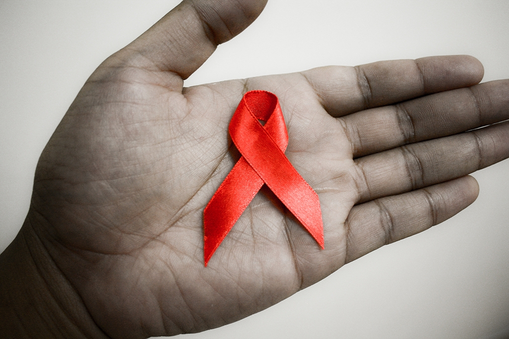 INSTITUT ZA JAVNO ZDRAVSTVO REPUBLIKE SRPSKE Svjetski dan borbe protiv HIV/AIDS-a - 1. decembar