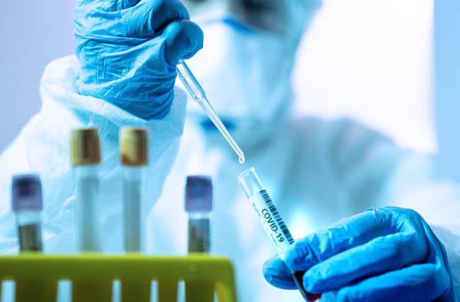 TRI PACIJENTA PREMINULA Virusom korona zaraženo još 135 osoba u Srpskoj