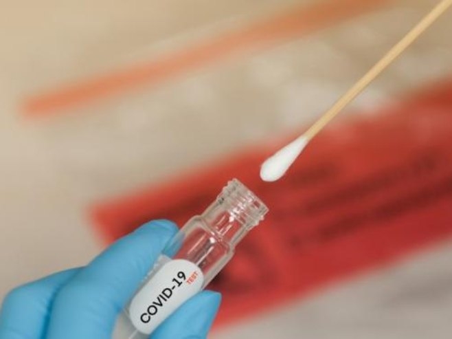 U Srpskoj 39 slučajeva virusa korona