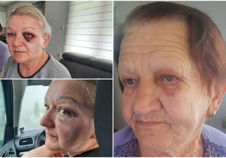 DOBOJ: Uhapšen odbornik US u Stanarima, brutalno pretukao suprugu, svastiku, punicu i punca