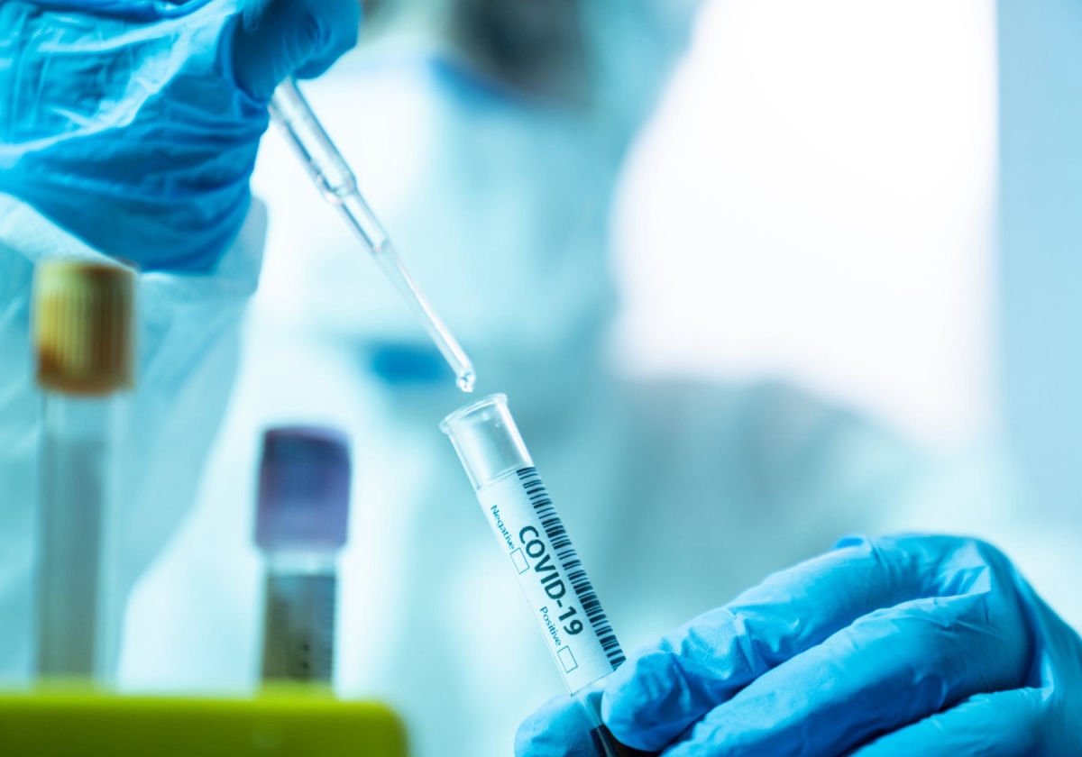 PREMINULO OSAM PACIJENATA Korona virus potvrđen kod još 263 osobe u Srpskoj