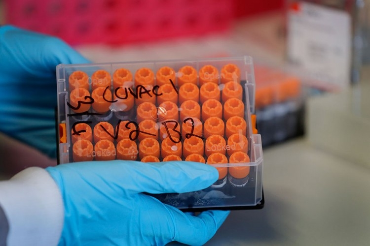 JOŠ DEVET ŽRTAVA OPAKE ZARAZE Virusom korona zaražena 41 osoba u Srpskoj