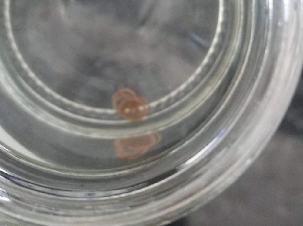 U VODI SA GRADSKOG VODOVODA: Pritužbe građana na prisustvo parazita (VIDEO)