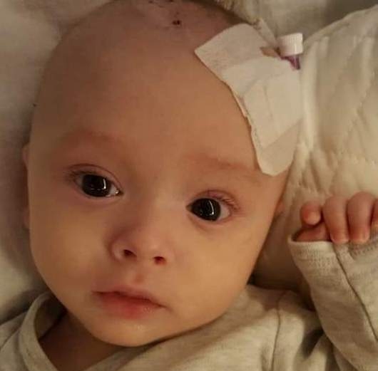 DOBOJSKI INFO APELUJE Šestomjesečni Arslan Kulačić hitno treba našu pomoć