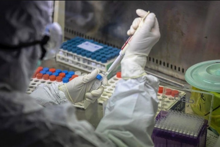 BITKU IZGUBILO ŠEST ZARAŽENIH Na korona virus pozitivno još 19 građana Srpske