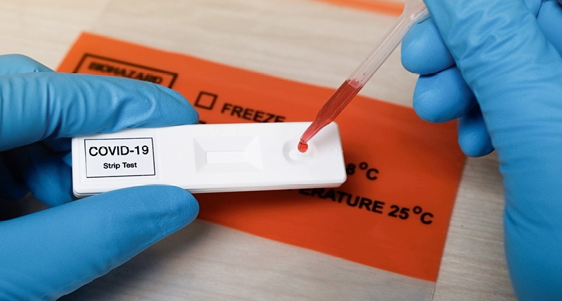 Devet osoba preminulo u Srpskoj, još 108 pozitivno na virus korona