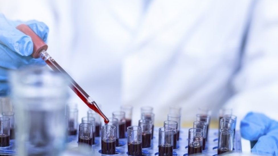 ZARAŽENO JOŠ 27 LJUDI Od virusa korona preminula četiri pacijenta u Srpskoj