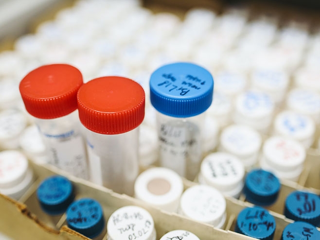 PREMINULO 17 OBOLJELIH Korona virus potvrđen kod još 236 osoba u Srpskoj