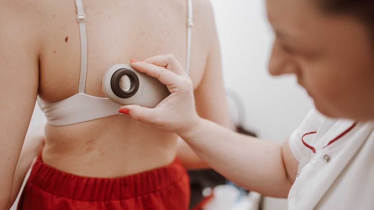 DOBOJ: U četvrtak besplatni dermoskopski pregledi mladeža