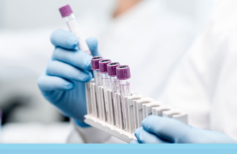 PREMINULO ŠEST PACIJENATA Na virus korona u Srpskoj pozitivno još 75 osoba