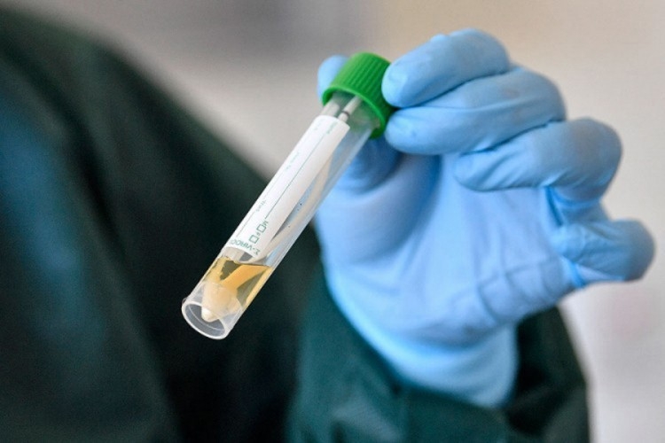 DOBOJ: Još 3 osobe pozitivne na virus korona