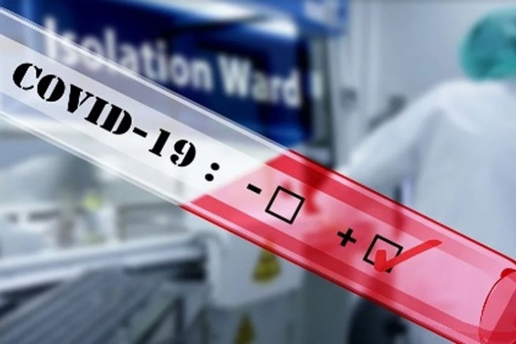 U Srpskoj 149 slučajeva virusa korona, sedam preminulih