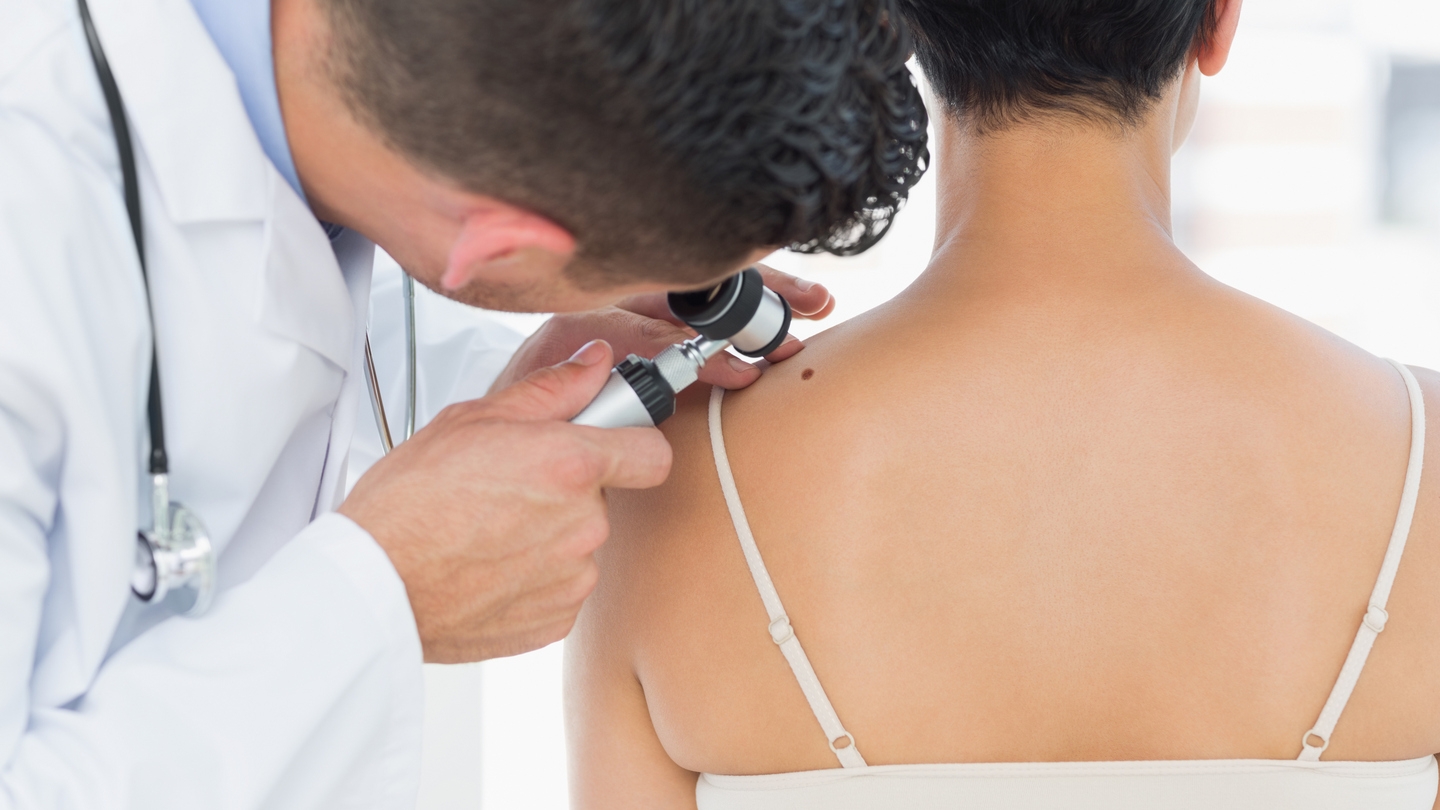 DOBOJ: Besplatan dermoskopski pregled u srijedu 31. maja u Domu zdravlja