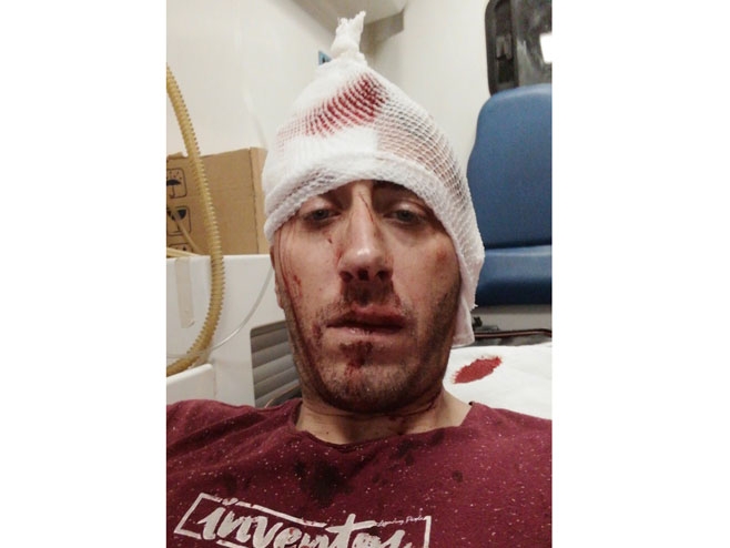 Pretučen novinar BN TV Vladimir Kovačević