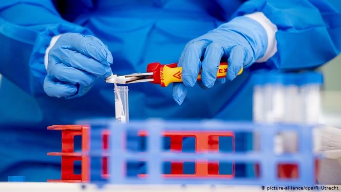 PREMINULA ČETIRI OBOLJELA Na korona virus pozitivno još 29 osoba u Srpskoj