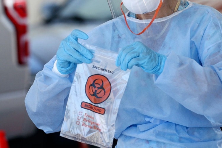 Još 129 osoba u Srpskoj pozitivno na virus korona, 9 u Doboju