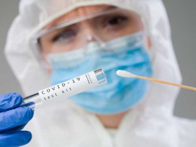 BITKU IZGUBIO PACIJENT OD 31 GODINU Korona virus potvrđen kod još 516 osoba u Srpskoj, 26 preminulih