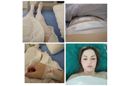 NATAŠI POTREBNA POMOĆ DOBRIH LJUDI "Želim da se izliječim da bih postala majka"